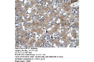 Human Liver (ZNF81 Antikörper  (Middle Region))