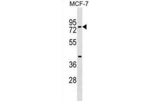 Western Blotting (WB) image for anti-TOX High Mobility Group Box Family Member 4 (TOX4) antibody (ABIN2999628) (TOX4 Antikörper)