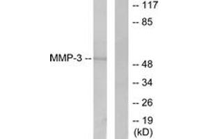 Western blot analysis of extracts from 293 cells, using MMP-3 Antibody. (MMP3 Antikörper  (AA 421-470))