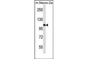 MAN2A2 Antikörper  (Middle Region)
