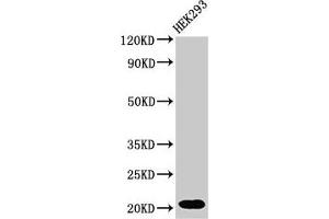 Western Blot Positive WB detected in: HEK293 whole cell lysate All lanes: RPS10P5 antibody at 2 μg/mL Secondary Goat polyclonal to rabbit IgG at 1/50000 dilution Predicted band size: 21 kDa Observed band size: 21 kDa (RPS10P5 Antikörper)