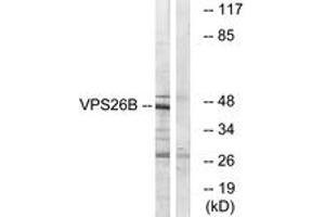 Western blot analysis of extracts from LOVO cells, using VPS26B Antibody. (VPS26B Antikörper  (AA 231-280))