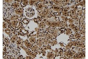 ABIN6255486 and ABIN6277780 at 1/100 staining Rat kidney tissue by IHC-P. (PKC epsilon Antikörper  (pSer729))