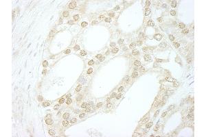 Immunohistochemistry (IHC) image for anti-V-Myb Myeloblastosis Viral Oncogene Homolog (Avian)-Like 2 (MYBL2) (AA 450-500) antibody (ABIN7448426)