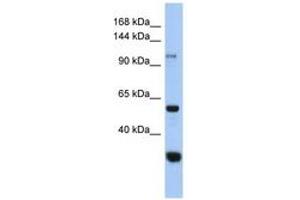 Image no. 1 for anti-Glucosidase, Alpha, Neutral C (GANC) (C-Term) antibody (ABIN6743902) (GANC Antikörper  (C-Term))