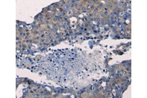 Immunohistochemistry (IHC) image for anti-Fibroblast Growth Factor 2 (Basic) (FGF2) antibody (ABIN2425614) (FGF2 Antikörper)