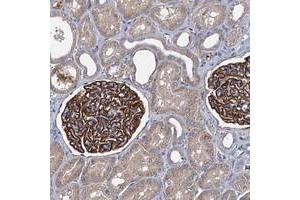 Immunohistochemical staining of human kidney with LRRC18 polyclonal antibody  shows distinct positivity in cells in glomeruli. (LRRC18 Antikörper)