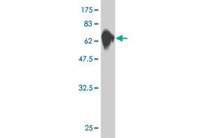 Western Blot detection against Immunogen (76. (MKNK1 Antikörper  (AA 1-465))