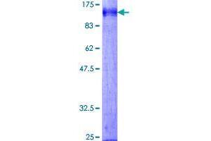 Image no. 1 for Death Inducer-Obliterator 1 (DIDO1) protein (GST tag) (ABIN1351598) (DIDO1 Protein (GST tag))