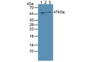Western blot analysis of (1) Human MCF-7 Cells, (2) Human SGC7901 Cells and (3) Human HeLa cells. (Cytokeratin 18 Antikörper  (AA 72-380))