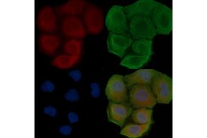ABIN6257755 and ABIN6273649 staining Hela cells(30 min of UV treatment) by IF/ICC. (IL12B Antikörper  (C-Term))