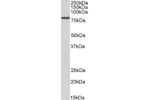 Biotinylated ABIN5539926 (2µg/ml) staining of A431 lysate (35µg protein in RIPA buffer), exactly mirroring its parental non-biotinylated product. (JUP Antikörper  (C-Term) (Biotin))