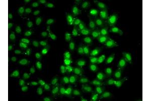 Immunofluorescence analysis of U2OS cells using PSMD8 antibody. (PSMD8 Antikörper)