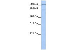 WB Suggested Anti-LZTR1 Antibody Titration:  0. (LZTR1 Antikörper  (N-Term))