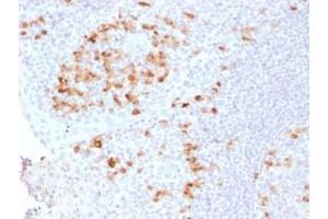 Formalin-fixed, paraffin-embedded human Tonsil stained with Kappa Light Chain Rabbit Recombinant Monoclonal (KLC2289R). (Rekombinanter IGKC Antikörper)
