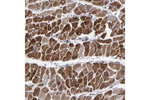 Immunohistochemical staining of human heart muscle with ZNF175 polyclonal antibody  shows strong cytoplasmic positivity in myocytes . (ZNF175 Antikörper)