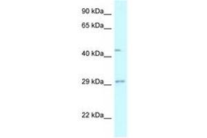 Image no. 1 for anti-Fucosyltransferase 8 (Alpha (1,6) Fucosyltransferase) (FUT8) (AA 27-76) antibody (ABIN6747582) (FUT8 Antikörper  (AA 27-76))