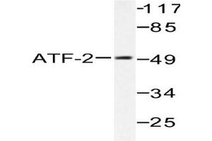 Image no. 2 for anti-Activating Transcription Factor 2 (ATF2) antibody (ABIN265319) (ATF2 Antikörper)