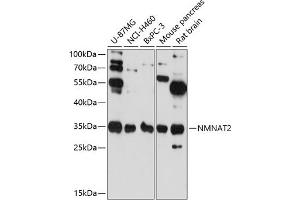 Western blot analysis of extracts of various cell lines, using NMN antibody (ABIN6129063, ABIN6144684, ABIN6144685 and ABIN6217965) at 1:3000 dilution. (NMNAT2 Antikörper  (AA 1-302))