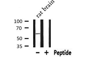 Western blot analysis of extracts from Rat brain lysate, using RAB11FIP2 antibody.