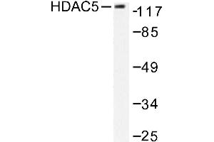 Image no. 1 for anti-Histone Deacetylase 5 (HDAC5) antibody (ABIN265456) (HDAC5 Antikörper)