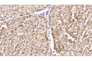 Immunohistochemistry (IHC) image for anti-Caspase 8 (CASP8) (AA 7-201) antibody (ABIN7444115)