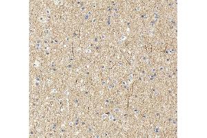 IHC analysis of UBE3A using anti-UBE3A antibody (ABIN7599562). (ube3a Antikörper  (AA 1-860))