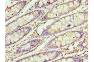 Immunohistochemistry of paraffin-embedded human colon tissue using ABIN7171070 at dilution of 1:100 (SMARCB1 Antikörper  (AA 86-385))