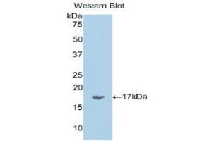 Western blot analysis of the recombinant protein. (Chemerin Antikörper  (AA 25-152))