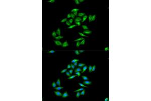 Immunofluorescence (IF) image for anti-Carnitine Palmitoyltransferase 1A (Liver) (CPT1A) antibody (ABIN1876495) (CPT1A Antikörper)
