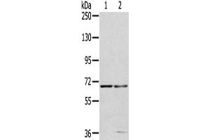 Gel: 6 % SDS-PAGE,Lysate: 40 μg,Lane 1-2: 293T cells, HepG2 cells,Primary antibody: ABIN7191487(MMP24 Antibody) at dilution 1/200 dilution,Secondary antibody: Goat anti rabbit IgG at 1/8000 dilution,Exposure time: 40 seconds (MMP24 Antikörper)