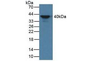 Detection of aZGP1 in Human Serum using Polyclonal Antibody to Alpha-2-Glycoprotein 1, Zinc Binding (aZGP1) (AZGP1 Antikörper  (AA 148-298))