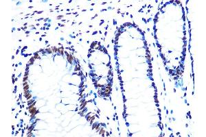 Immunohistochemistry of paraffin-embedded human colon using NUM Rabbit mAb (ABIN7269002) at dilution of 1:100 (40x lens).