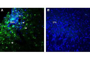 Expression of Glycine Receptor alpha 3 in rat dorsal raphe nucleus (DRN). (GLRA3 Antikörper  (AA 355-368))