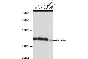 Western blot analysis of extracts of various cell lines, using NDUFB8 Rabbit mAb (ABIN7268813) at 1:1000 dilution. (NDUFB8 Antikörper)