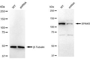 Western blotting analysis using SPINK5 antibody (ABIN7800302).