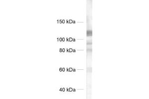 dilution: 1 : 500, sample: crude synaptosomal fraction of rat brain (P2) (GRIP1 Antikörper  (AA 662-769))