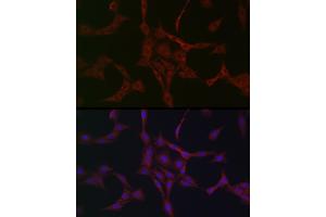 Immunofluorescence analysis of PC-12 cells using NBR1 Rabbit pAb (ABIN1680974, ABIN3018329 and ABIN3018330) at dilution of 1:50 (40x lens). (NBR1 Antikörper)