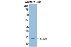 Detection of Recombinant IL1R1, Human using Polyclonal Antibody to Interleukin 1 Receptor Type I (IL1R1) (IL1R1 Antikörper  (AA 226-318))