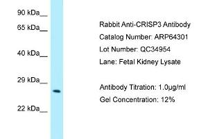 Western Blotting (WB) image for anti-Cysteine-Rich Secretory Protein 3 (CRISP3) (N-Term) antibody (ABIN2789797) (CRISP3 Antikörper  (N-Term))
