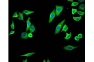 Immunofluorescence staining of HepG2 Cells with ABIN7127435 at 1:50, counter-stained with DAPI. (Rekombinanter PTGS2 Antikörper)
