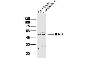 Lane 1: Mouse Cerebrum; Lane 2: Mouse Cerebellum lysates probed with GLRB Polyclonal Antibody, Unconjugated (bs-20450R) at 1:300 overnight at 4˚C. (GLRB Antikörper  (AA 51-150))