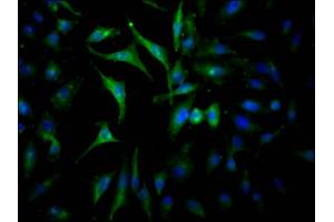 Immunofluorescence staining of Hela Cells with ABIN7127587 at 1:50, counter-stained with DAPI. (Rekombinanter JAK2 Antikörper)