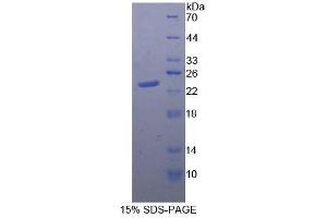 SDS-PAGE (SDS) image for Protein Tyrosine Phosphatase, Receptor Type, N (PTPRN) (AA 368-575) protein (His tag) (ABIN1878207)