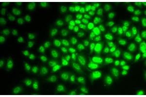 Immunofluorescence analysis of HeLa cells using CCNG1 Polyclonal Antibody (Cyclin G1 Antikörper)