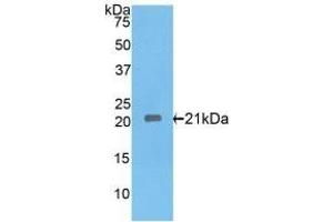 Detection of Recombinant IL17RE, Rat using Polyclonal Antibody to Interleukin 17 Receptor E (IL17RE) (IL17RE Antikörper  (AA 457-626))