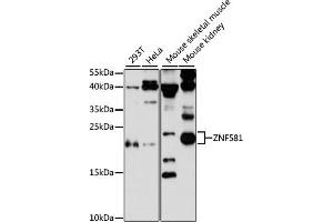 Western blot analysis of extracts of various cell lines, using ZNF581 antibody (ABIN6128960, ABIN6150520, ABIN6150521 and ABIN6217055) at 1:3000 dilution. (ZNF581 Antikörper  (AA 1-90))