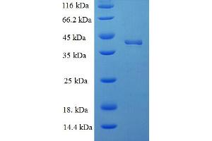 SDS-PAGE (SDS) image for Docking Protein 5 (DOK5) (AA 1-198), (Isoform 2) protein (His-SUMO Tag) (ABIN5709417)