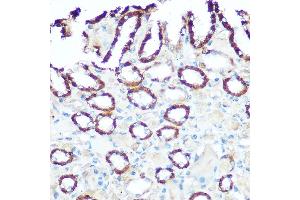 Immunohistochemistry (IHC) image for anti-NADH Dehydrogenase (Ubiquinone) Flavoprotein 1, 51kDa (NDUFV1) (AA 1-250) antibody (ABIN6144498)