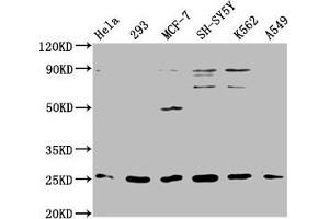 Western Blot Positive WB detected in: Hela whole cell lysate, 293 whole cell lysate, MCF-7 whole cell lysate, SH-SY5Y whole cell lysate, K562 whole cell lysate, A549 whole cell lysate All lanes: ARHGDIG antibody at 1:2000 Secondary Goat polyclonal to rabbit IgG at 1/50000 dilution Predicted band size: 26 kDa Observed band size: 26 kDa (ARHGDIG Antikörper  (AA 1-225))